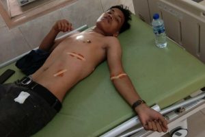 Bikin Konten di Kebun Bunga Pematangsiantar, YouTuber Ini Ditikam Pengamen