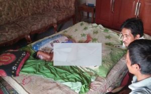 Waduh! Seorang Bocah di Cilaku Cianjur Alami Luka Bakar Parah Akibat Main Petasan
