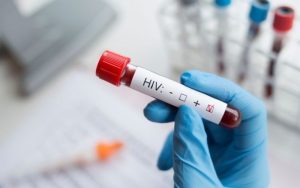 Ini Data Kasus HIV/AIDS di Pangandaran Selama Pandemi Covid-19, Ada Kenaikan?