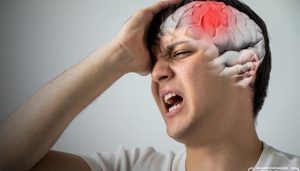 Stroke Bisa Menyerang Usia Muda, Pahami Ini Gejalanya