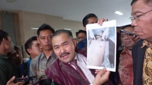 Brigadir J Diduga Disiksa Sebelum Meninggal, Kuasa Hukum Keluarga Ungkap Ini