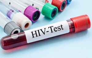 Karakteristik Penderita HIV