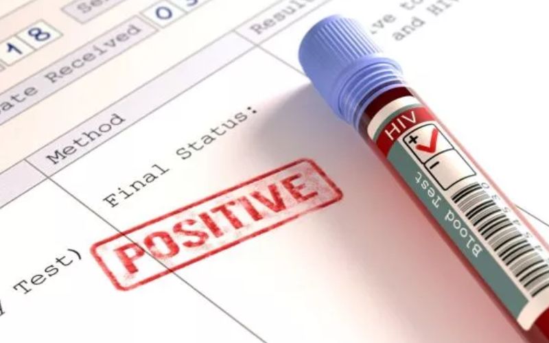Pasien HIV di Serdang Bedagai Capai 95 Orang, Paling Banyak Pelaku Homoseksual