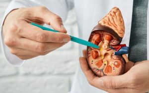 Waduh Kasus Gagal Ginjal Kembali Marak, Dinkes Ungkap Begini
