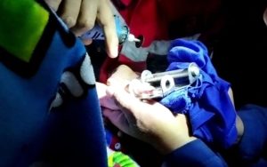 Duh! Berwisata ke Purwakarta, Jari Bocah Asal Bandung Tersangkut Lubang Slot Kunci