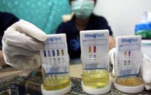 Wah! Panik Gak? Pejabat di Pemkot Tasikmalaya Bakal Dites Urine!