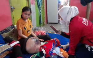 Kisah Aisah Si Penderita Tumor Ganas yang Takut Diamputasi, Dinkes Cianjur Lakukan Langkah Ini