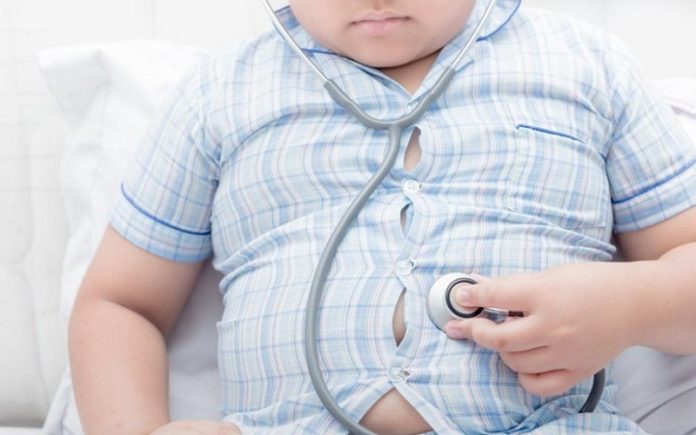 Obesitas Anak