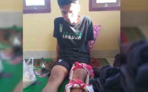 Kader HMI Patah Tulang Kaki saat Unjuk Rasa di Tasikmalaya, Begini Kronologinya