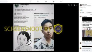 Gibran Disebut Alami Gangguan Tortikolis, Cek Faktanya