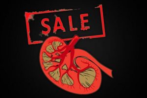 Ini Cerita Caleg Jual Ginjal Demi Biaya Kampanye, Tarnyata…