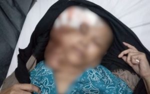 Seorang Warga di Cianjur Derita Tumor Ganas, Dinkes Sebut Karena Ini