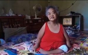Kulit Tubuhnya Melepuh dan Keluar Nanah, Penyandang Disabilitas Asal Mande Cianjur Ini Luput dari Perhatian Pemerintah