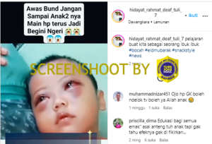 Mata Anak Bengkak dan Merah Akibat Terlalu Lama Main HP, Ini Faktanya
