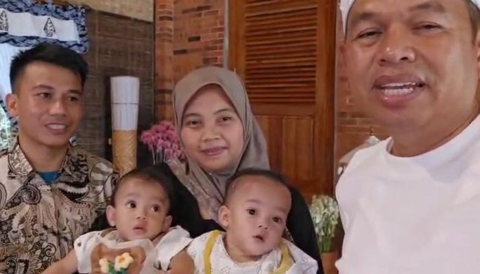Dedi Mulyadi Putuskan Bantu Bayi Kembar Siam Asal Tasikmalaya, Segera Jalani Operasi Tanpa Biaya