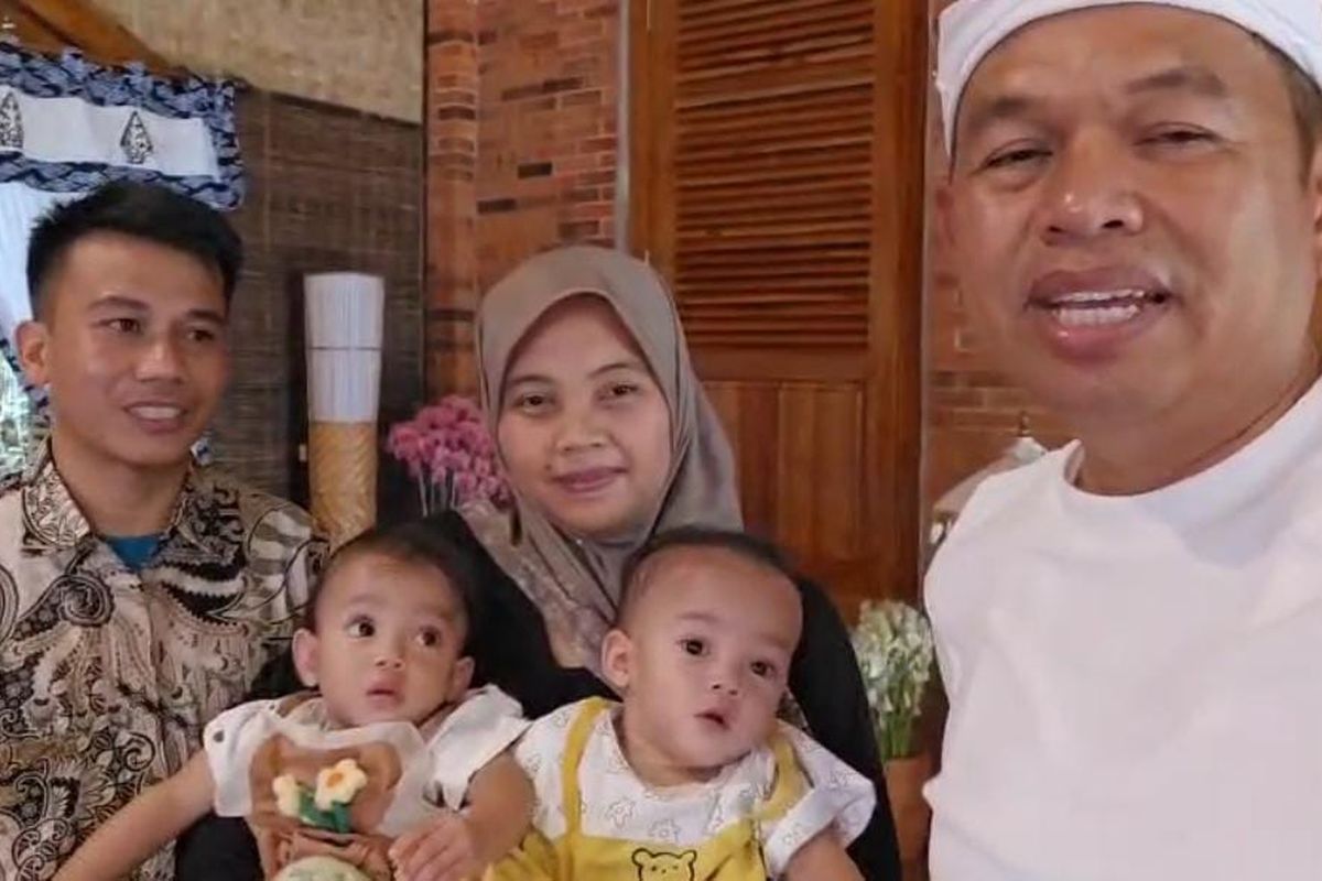 Bayi Kembar Siam