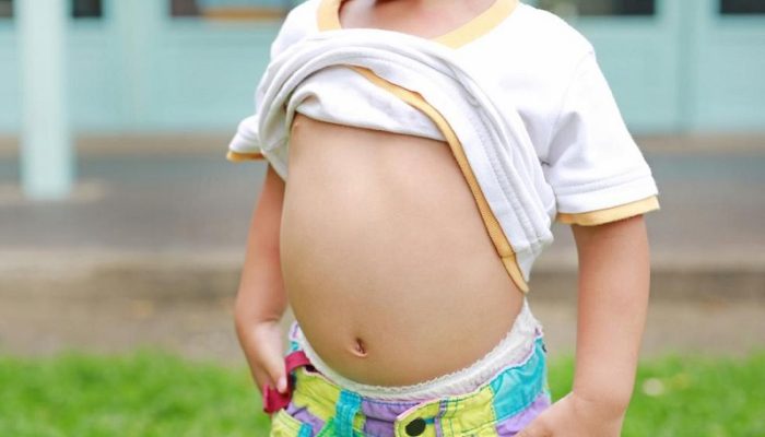 Penyakit Cacingan Masih Jadi Ancaman Serius bagi Anak di Subang
