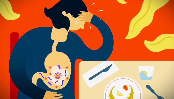 Diduga Keracunan, Puluhan Siswa SMP Lembang KBB Tumbang Usai Santap MBG