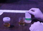 BNN Turun Gunung, Sopir Bus Dites Urine di Kawasan Wisata Lembang