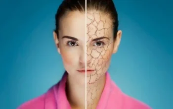 Ilustrasi wanita memeriksa kondisi kulit kering sebagai tanda tubuh kekurangan vitamin C bagi warga Purwakarta.