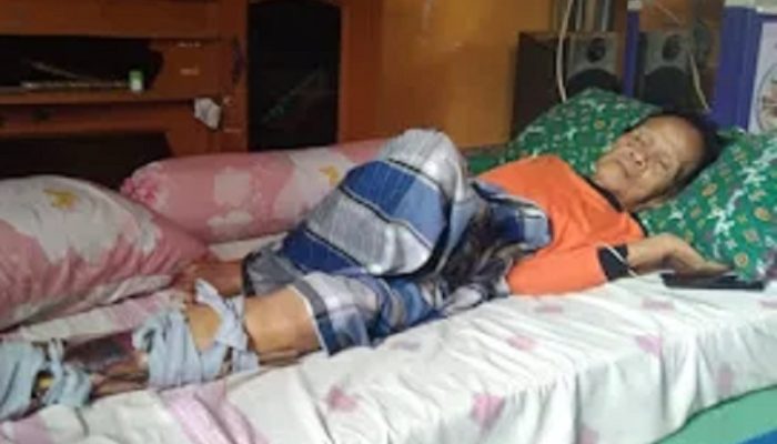 Korban Tabrak Motor di Cianjur Kesulitan Pulih, Butuhkan Bantuan Kursi Roda