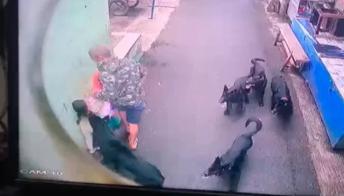 2 Bocah Digigit Anjing Hingga Kejang, Pemkot Bandung Turun Tangan