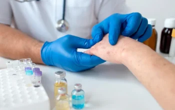 Layanan vaksinasi campak gratis di pos kesehatan mudik Jabar 2026.