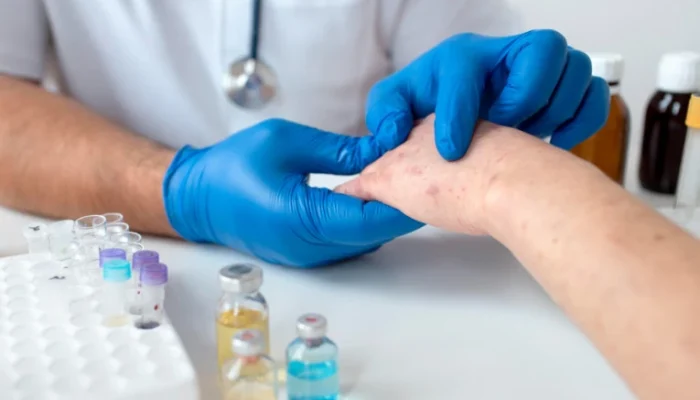 Kasus Suspek Campak di Cianjur Turun, Pemkab Gencarkan Vaksinasi